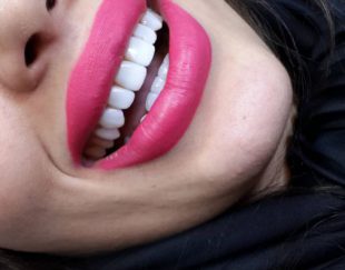 جذب دندانپزشک عمومی و زیبایی