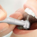 استخدام دندانپزشک جهت همکاری در مطب واقع در اهواز