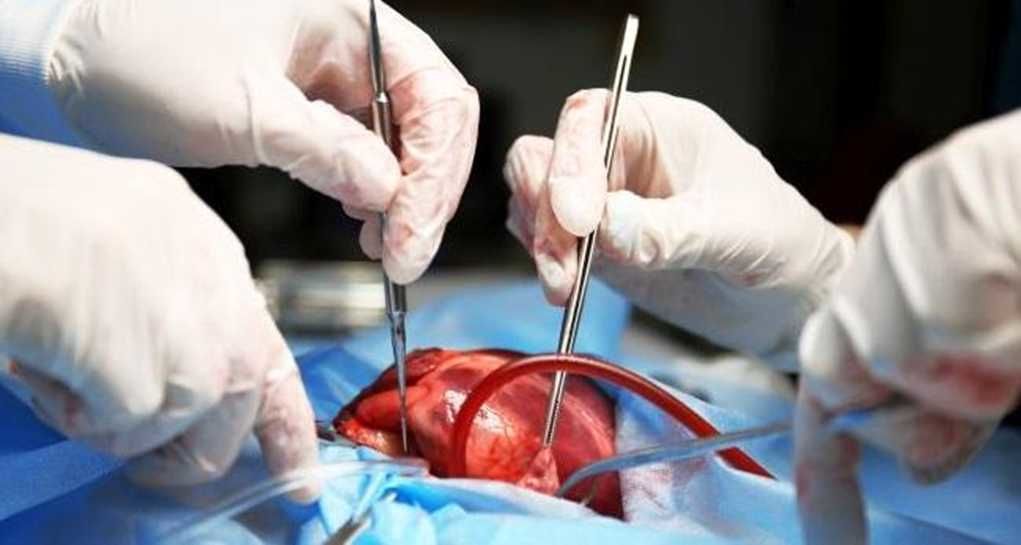 پزشک جراح قلب