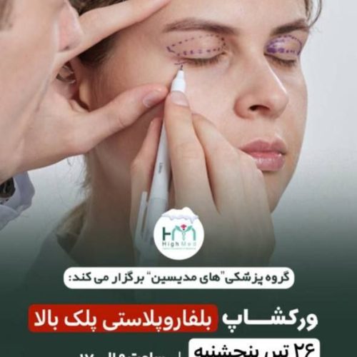 کارگاه حضورى آموزش بلفاروپلاستى پلک فوقانى