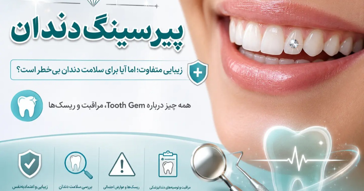 آیا پیرسینگ دندان از نظر سلامتی مورد تایید است ؟