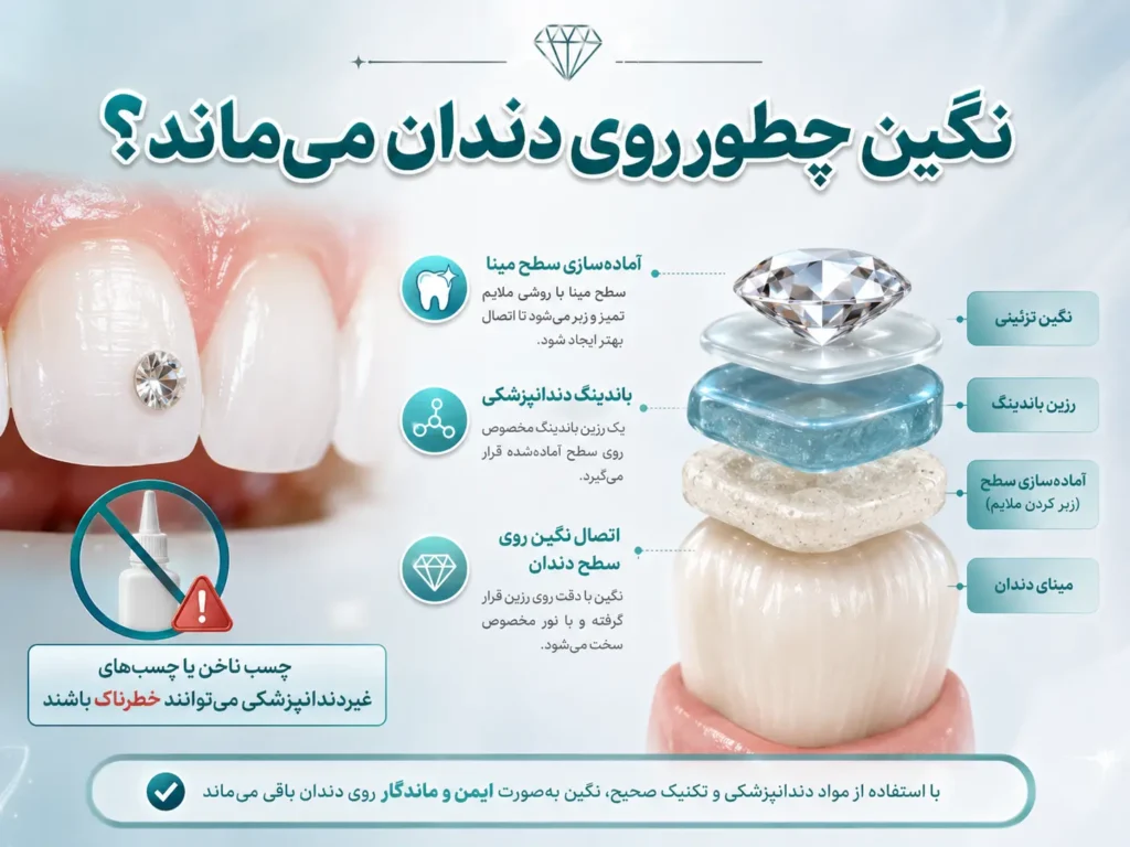 مهم‌ترین مسئله؛ تمیز کردن اطراف زیور